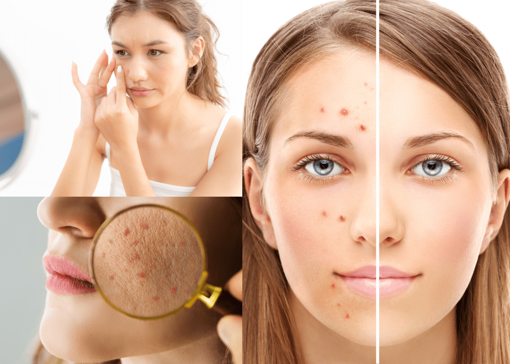 Ultimate Skincare Routine for Teenagers: A Complete&nbsp;Guide